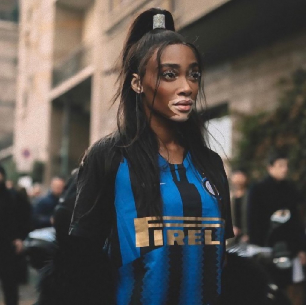 Winnie Harlow (1)