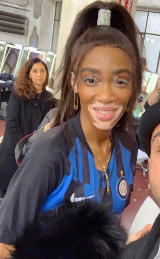 Winnie Harlow (2)
