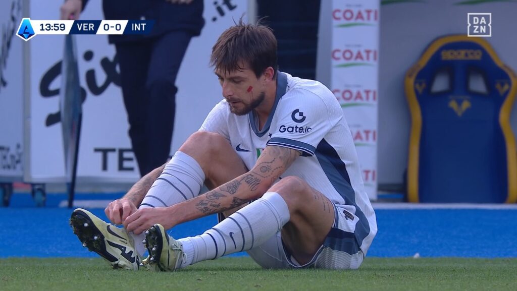 Acerbi