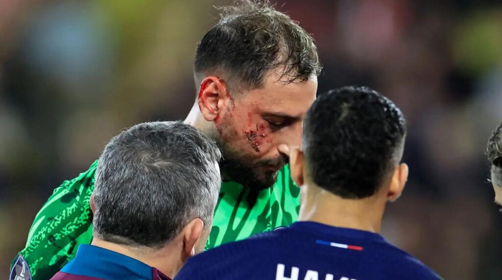 Donnarumma colpito