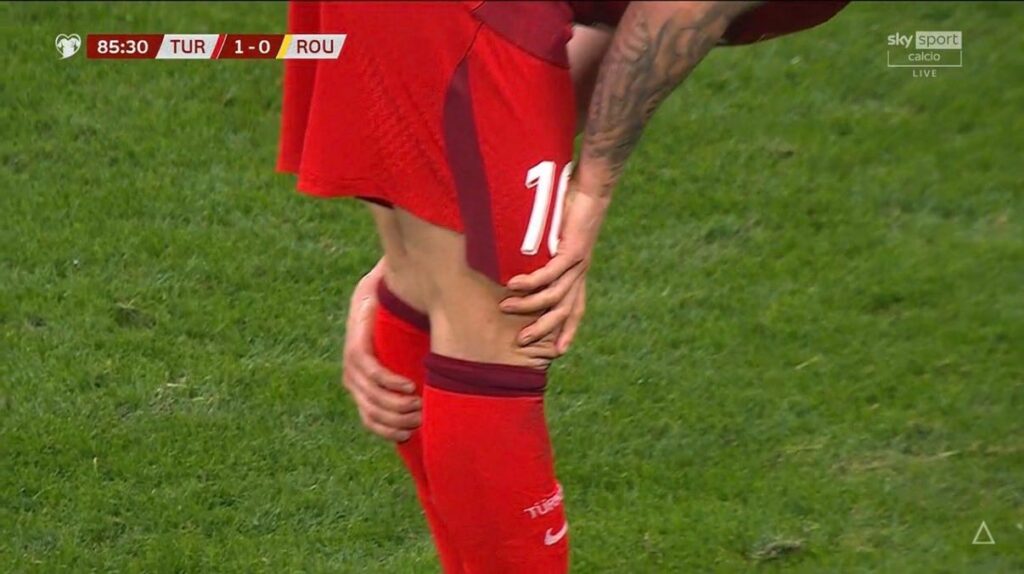 calhanoglu polpaccio turchia